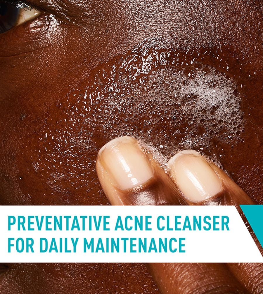Acne Control Cleanser - CERAVE