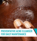 Acne Control Cleanser - CERAVE