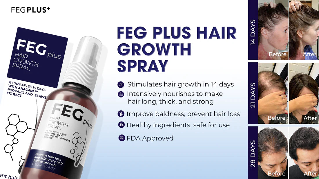 FEGPLUS Minoxidil Hair & Beard Growth Serum (50ml),