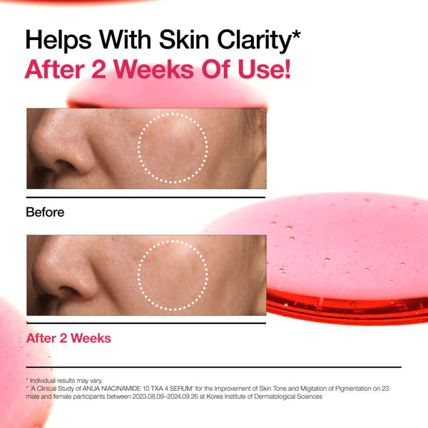ANUA Niacinamide 10 + TXA 4 Serum - ANUA