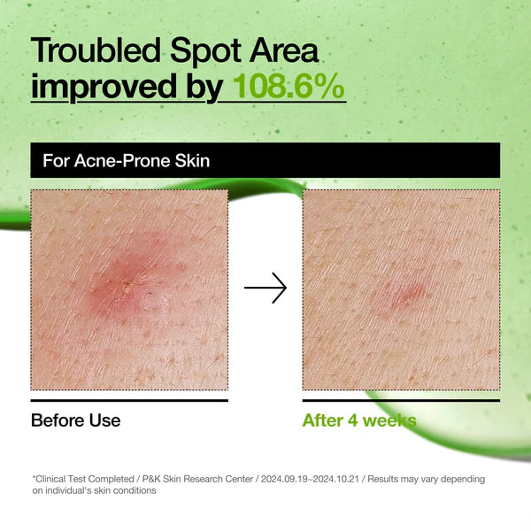 Azelaic Acid 10 Hyaluron Redness Soothing Serum  - ANUA