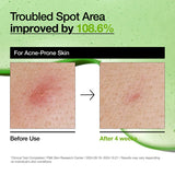 Azelaic Acid 10 Hyaluron Redness Soothing Serum  - ANUA
