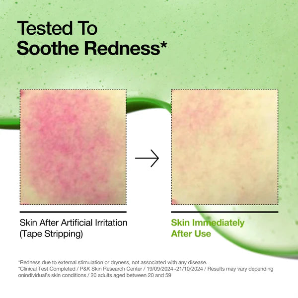 Azelaic Acid 10 Hyaluron Redness Soothing Serum  - ANUA