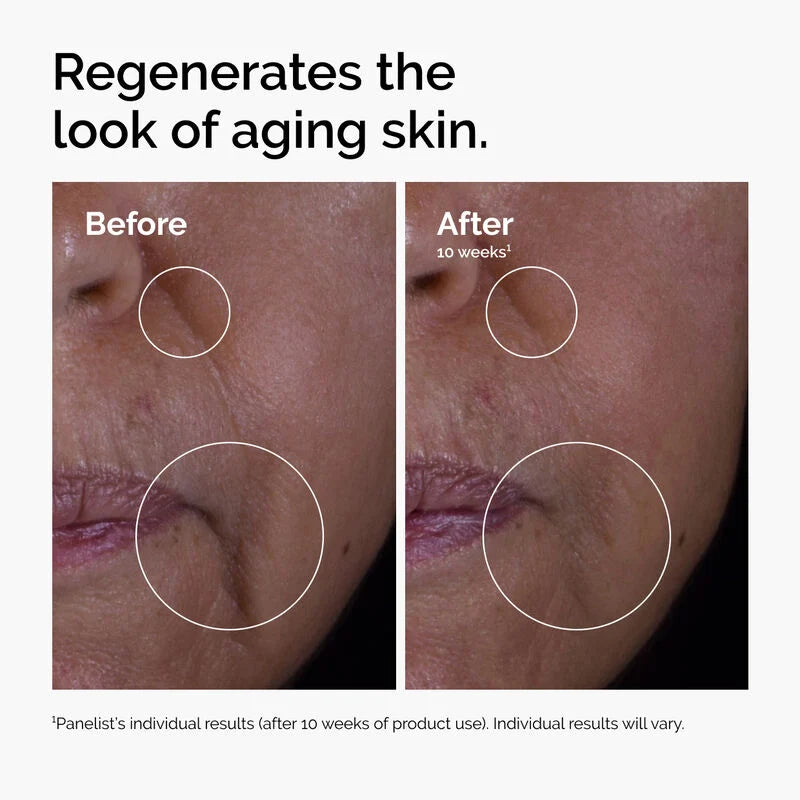 GF 15% Solution - The Ordinary
